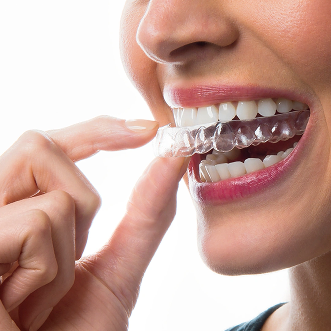 Orthodontic Consultation