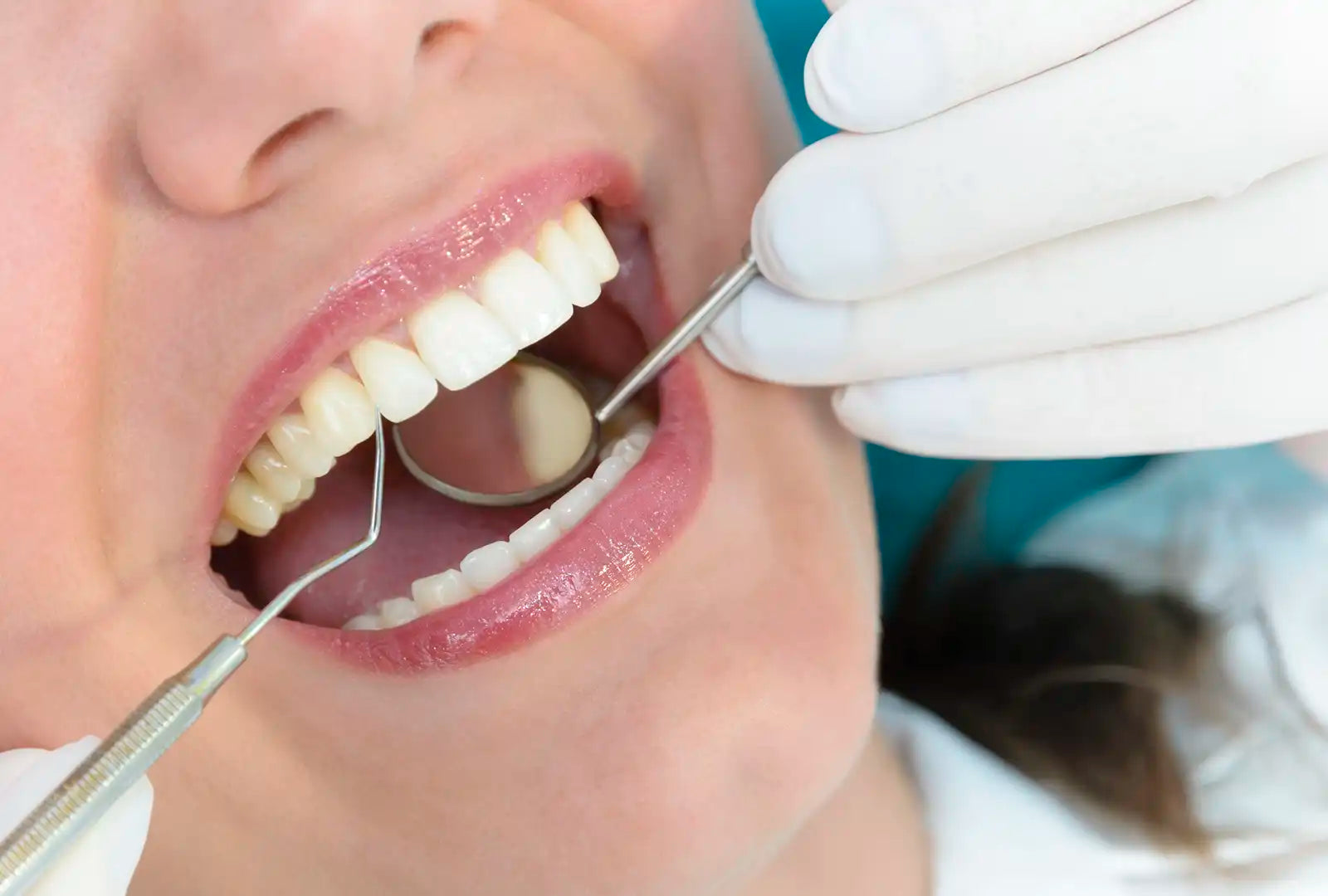 Dentist explaining prevention