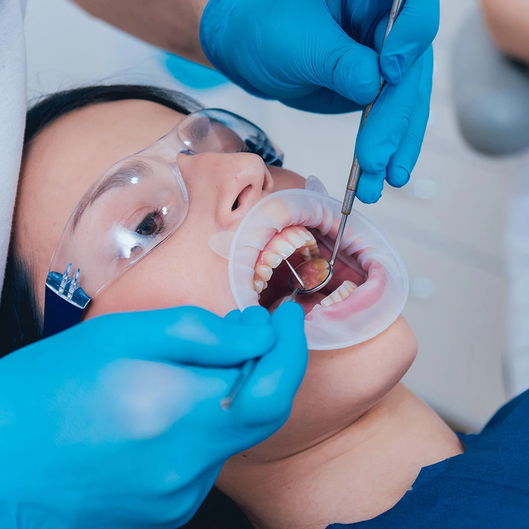 Benefits of Root Canal Treatment