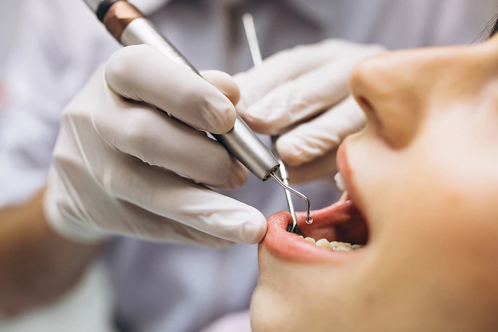 Root-End Filling Procedures