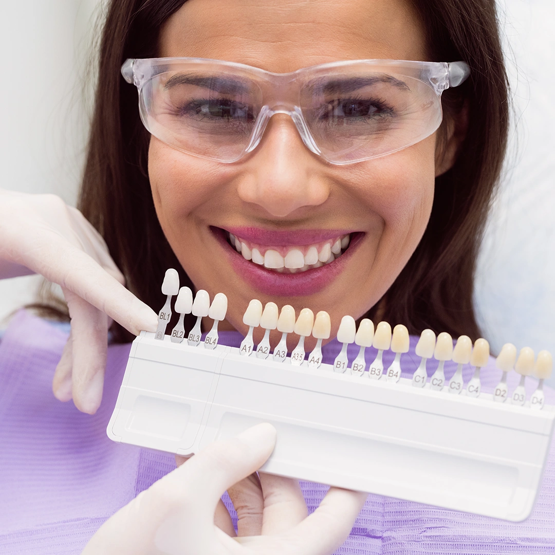 Dental Veneer Planning