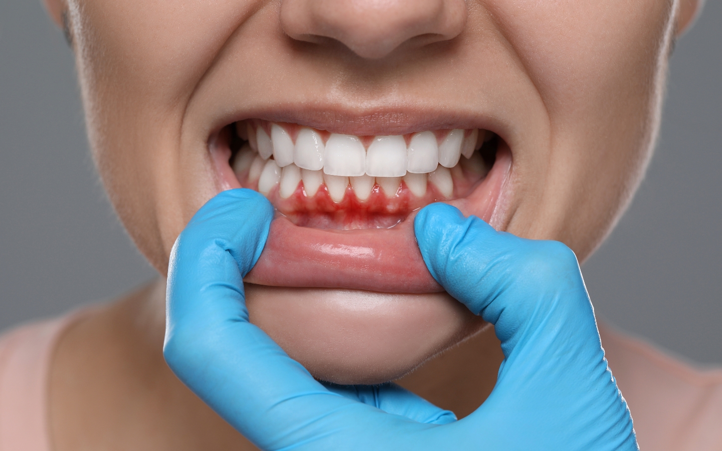 Gum Disease Periodontal Care