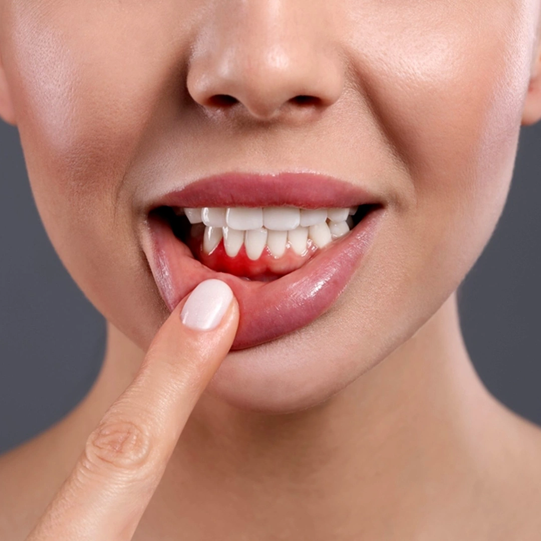Cosmetic Dental Consultation